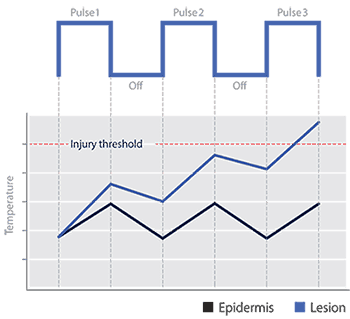 Multiple-Sequential Pulsing